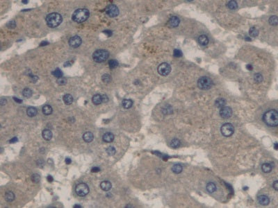 Procalcitonin (PCT) Monoclonal Antibody - image 5