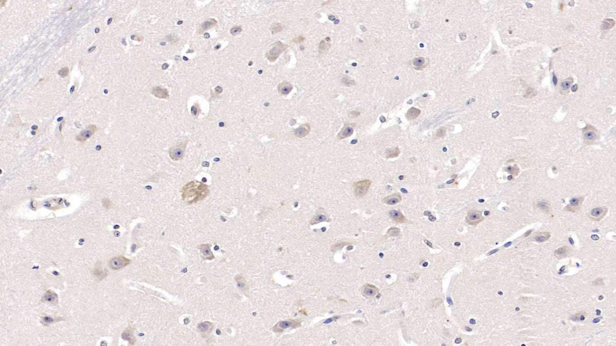 DAB staining on IHC-P; Sample: Human Liver Tissue; Primary Ab: 10ug/ml Rabbit Anti-Human CYP1A2 Antibody; Second Ab: 2ug/mL HRP-Linked Caprine Anti-Rabbit IgG Polyclonal Antibody