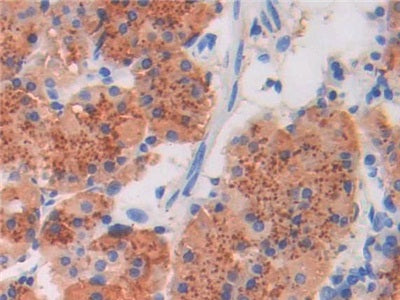 DAB staining on IHC-P; Sample: Human Liver Tissue; Primary Ab: 30ug/ml Mouse Anti-Human BNP Antibody; Second Ab: 2ug/mL HRP-Linked Caprine Anti-Mouse IgG Polyclonal Antibody