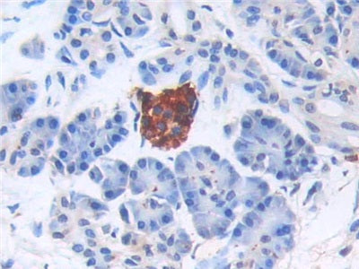 DAB staining on IHC-P; Sample: Human Cerebrum Tissue; Primary Ab: 30ug/ml Mouse Anti-Human BNP Antibody; Second Ab: 2ug/mL HRP-Linked Caprine Anti-Mouse IgG Polyclonal Antibody