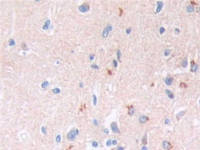 Brain Natriuretic Peptide (BNP) Monoclonal Antibody - image 5