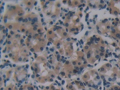 DAB staining on IHC-P; Sample: Human Prostate Tissue; Primary Ab: 30ug/ml Mouse Anti-Human NTXI Antibody; Second Ab: 2ug/mL HRP-Linked Caprine Anti-Mouse IgG Polyclonal Antibody