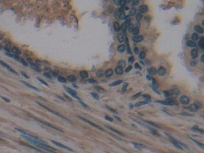 Cross Linked N-Telopeptide Of Type I Collagen (NTXI) Monoclonal Antibody - image 3