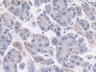DAB staining on IHC-P; Sample: Human Stomach Tissue; Primary Ab: 20ug/ml Mouse Anti-Human NTXI Antibody; Second Ab: 2ug/mL HRP-Linked Caprine Anti-Mouse IgG Polyclonal Antibody