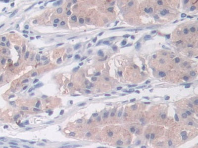 DAB staining on IHC-P; Sample: Human Kidney Tissue; Primary Ab: 20ug/ml Mouse Anti-Human NTXI Antibody; Second Ab: 2ug/mL HRP-Linked Caprine Anti-Mouse IgG Polyclonal Antibody