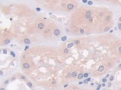 DAB staining on IHC-P; Sample: Human Cerebrum Tissue; Primary Ab: 20ug/ml Mouse Anti-Human NTXI Antibody; Second Ab: 2ug/mL HRP-Linked Caprine Anti-Mouse IgG Polyclonal Antibody