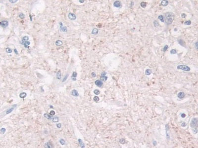 Cross Linked N-Telopeptide Of Type I Collagen (NTXI) Monoclonal Antibody - image 5
