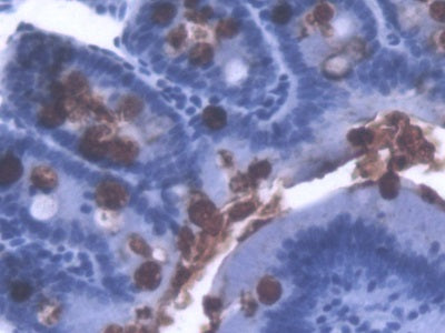 DAB staining on IHC-P; Sample: Rat Colon Tissue; Primary Ab: 20ug/ml Mouse Anti-Multi-species LPS Antibody; Second Ab: 2ug/mL HRP-Linked Caprine Anti-Mouse IgG Polyclonal Antibody