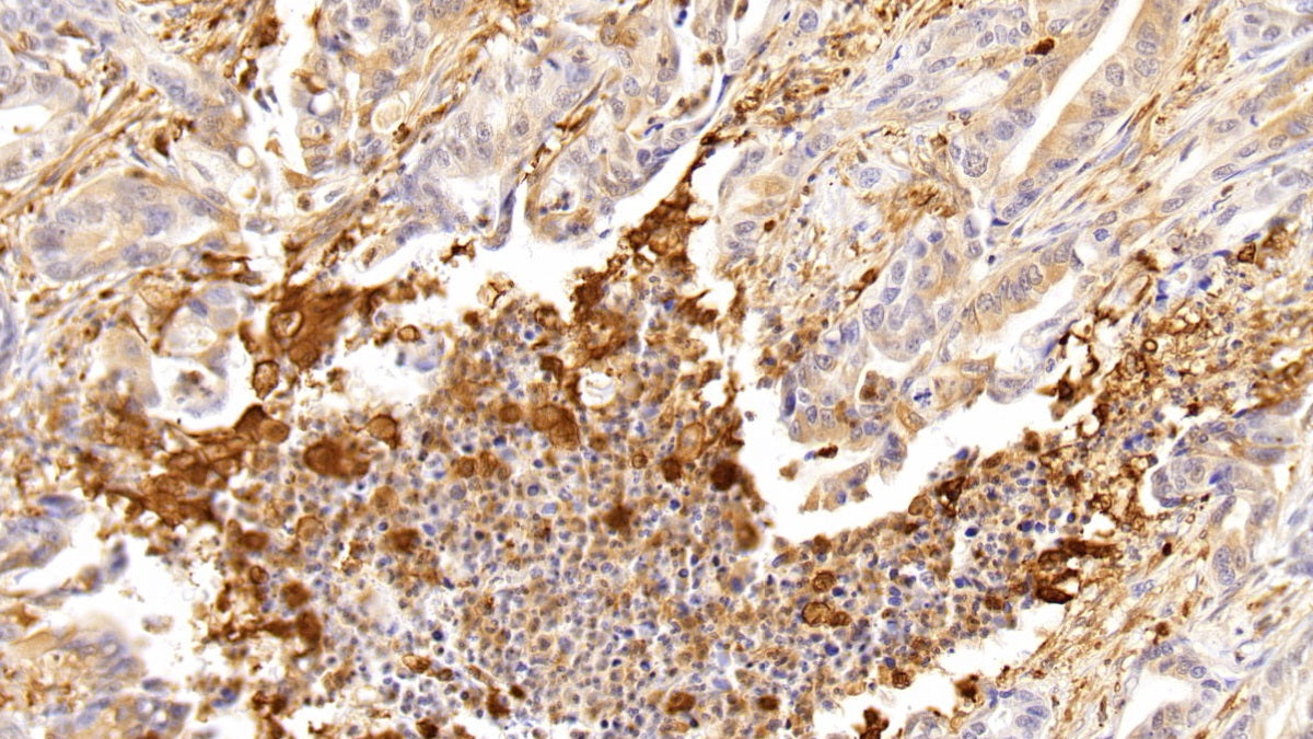 Tumor Protein p53 (P53) Polyclonal Antibody - image 5