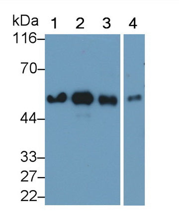 Vitamin D Binding Protein (DBP) Monoclonal Antibody - image 2