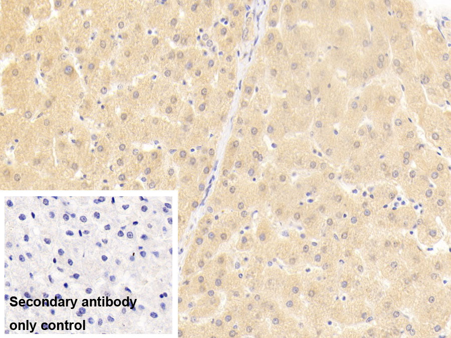 DAB staining on IHC-P; Sample: Porcine Skeletal muscle Tissue; Primary Ab: 20ug/ml Rabbit Anti-Human HGS Antibody; Control: Used PBS instead of primary antibody; Second Ab: 2ug/ml HRP-Linked Caprine Anti-Rabbit IgG Polyclonal Antibody