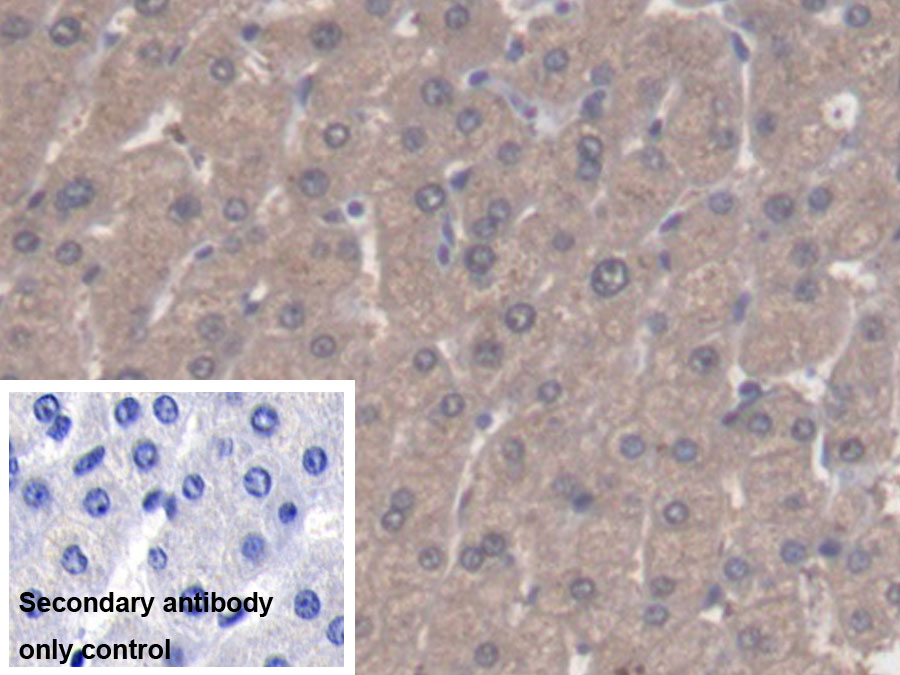 DAB staining on IHC-P; Sample: Human Stomach Tissue; Primary Ab: 20ug/ml Rabbit Anti-Human ALDH1A1 Antibody; Control: Used PBS instead of primary antibody; Second Ab: 2ug/ml HRP-Linked Caprine Anti-Rabbit IgG Polyclonal Antibody