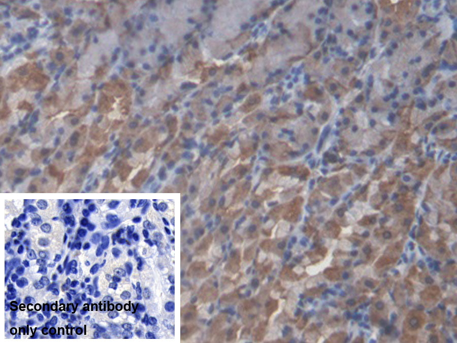 DAB staining on IHC-P; Sample: Human Pancreas Tissue; Primary Ab: 20ug/ml Rabbit Anti-Human ALDH1A1 Antibody; Control: Used PBS instead of primary antibody; Second Ab: 2ug/ml HRP-Linked Caprine Anti-Rabbit IgG Polyclonal Antibody