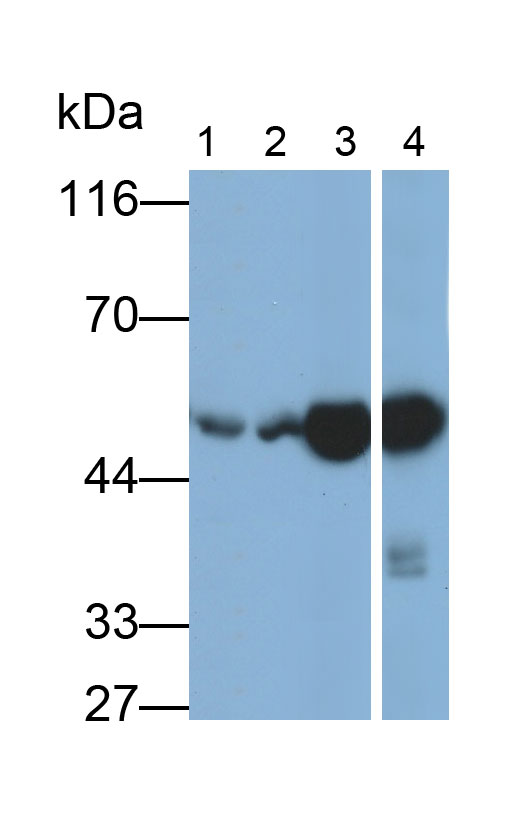 Aldehyde Dehydrogenase 1 Family, Member A1 (ALDH1A1) Polyclonal Antibody - image 5