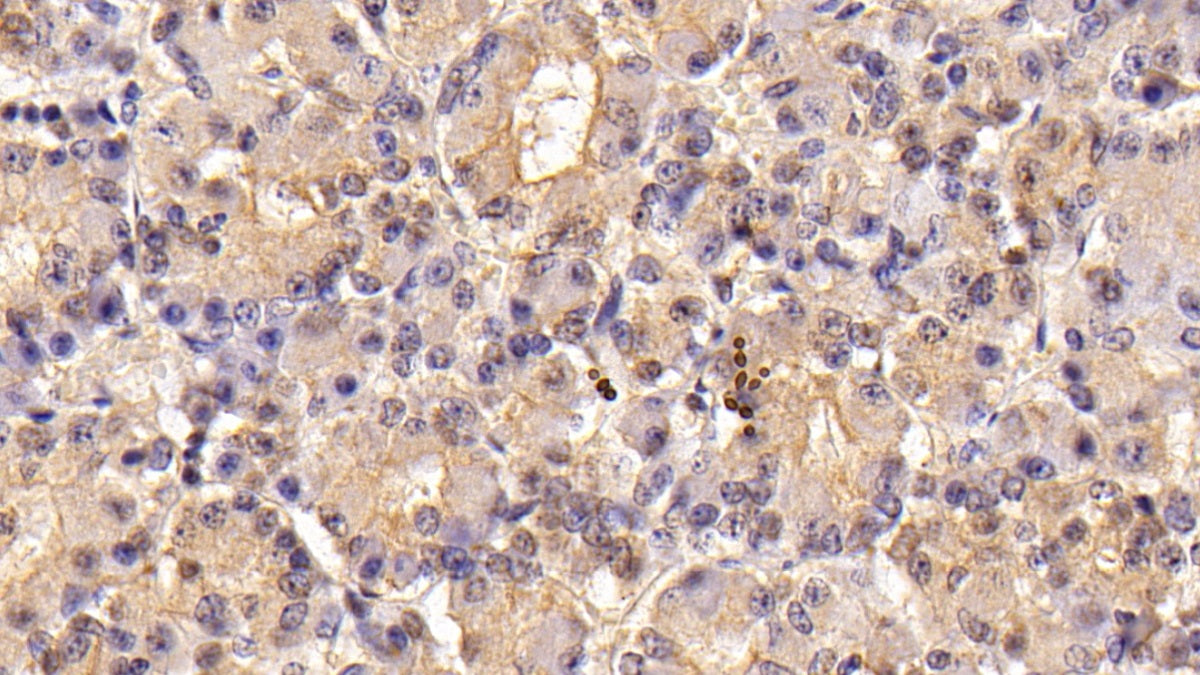 Follicle Stimulating Hormone Beta (FSHb) Monoclonal Antibody - image 2