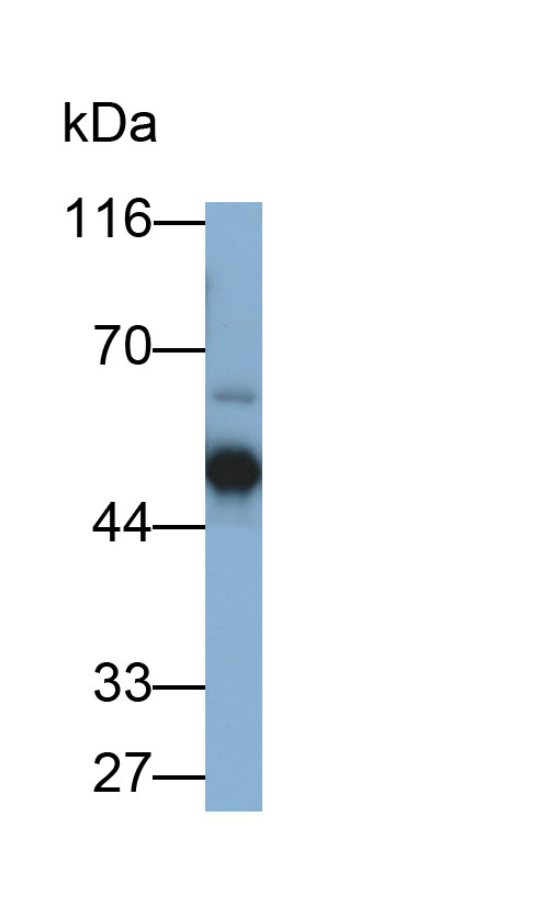 Western Blot; Sample: Jurkat cell lysate; Primary Ab: 0.05ug/ml Rabbit Anti-Mouse ANXA7 Antibody; Second Ab: 0.2ug/ml HRP-Linked Caprine Anti-Rabbit IgG Polyclonal Antibody