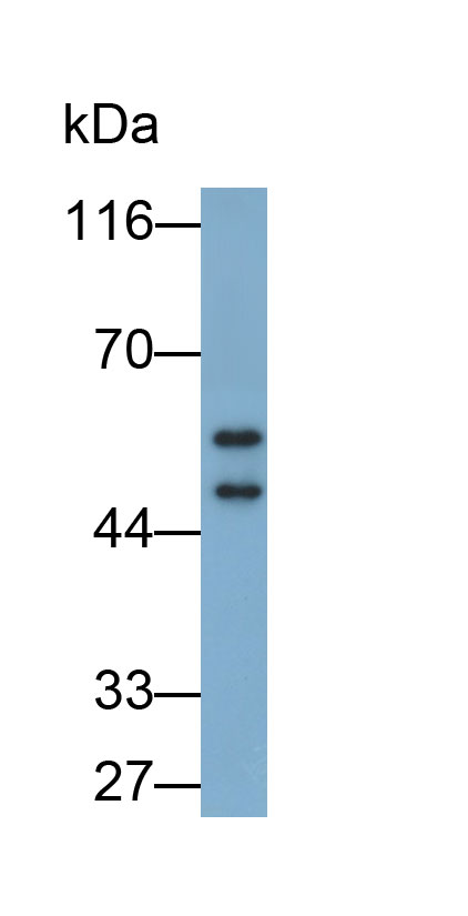 Annexin A7 (ANXA7) Polyclonal Antibody - image 3