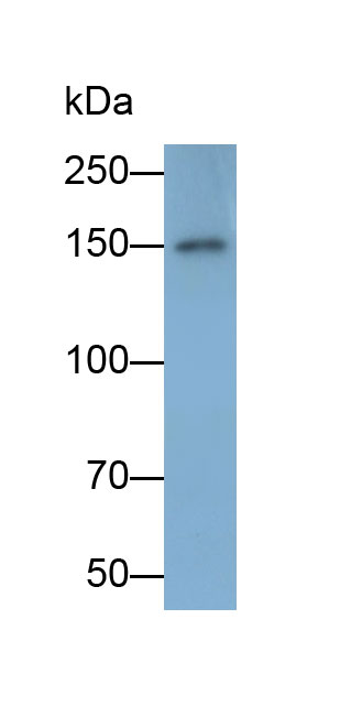 Tyrosine Kinase With Immunoglobulin Like And EGF Like Domains Protein 1 (Tie1) Polyclonal Antibody - image 2