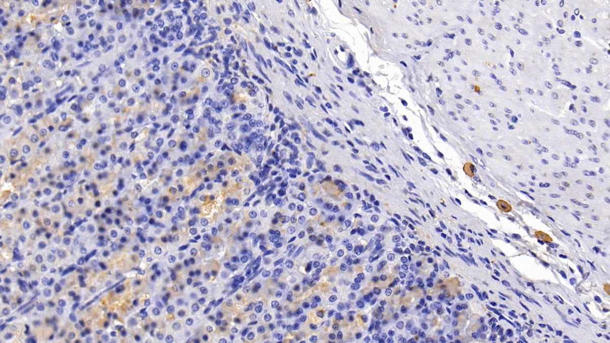 DAB staining on IHC-P; Sample: Rat Skeletal muscle Tissue; Primary Ab: 30ug/ml Mouse Anti-Human CCR7 Antibody; Second Ab: 2ug/mL HRP-Linked Caprine Anti-Mouse IgG Polyclonal Antibody