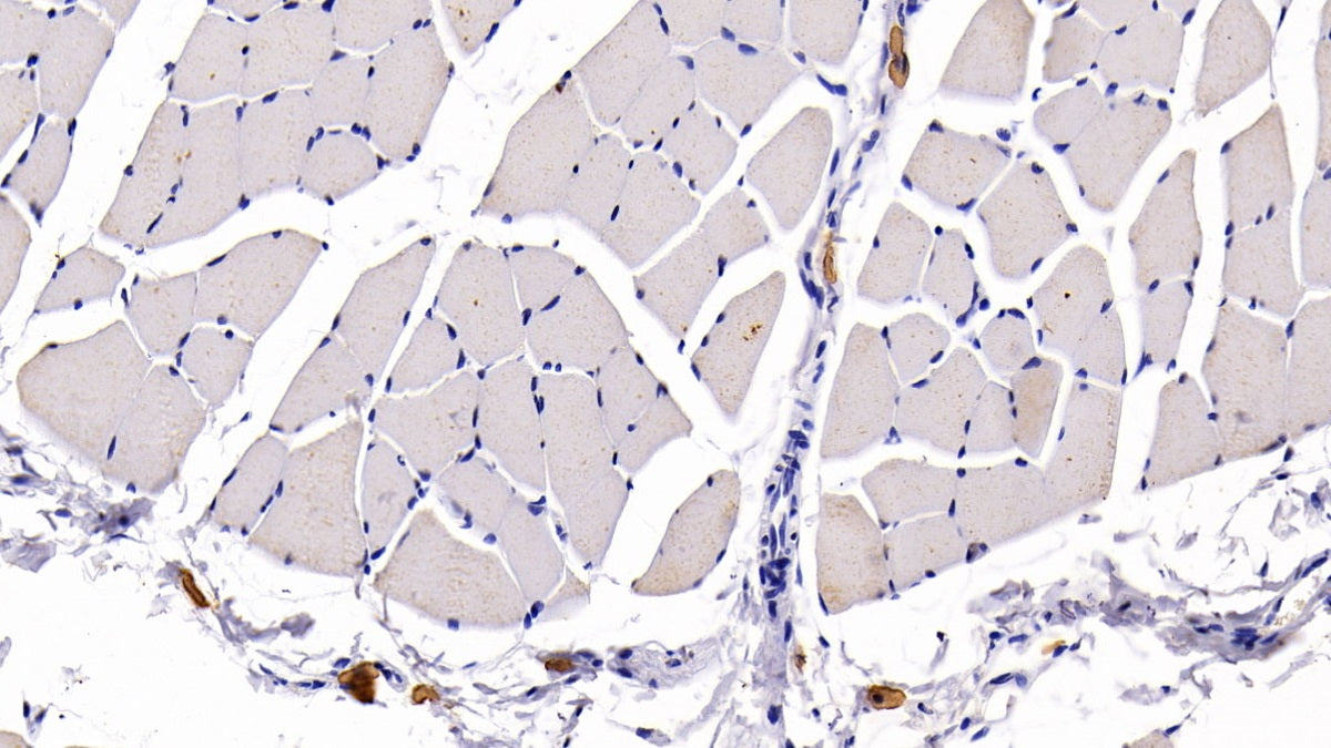 DAB staining on IHC-P; Sample: Rat Lymph node Tissue; Primary Ab: 30ug/ml Mouse Anti-Human CCR7 Antibody; Second Ab: 2ug/mL HRP-Linked Caprine Anti-Mouse IgG Polyclonal Antibody