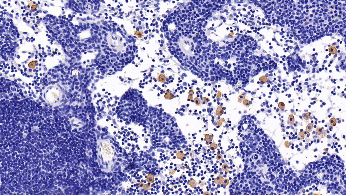 Chemokine C-C-Motif Receptor 7 (CCR7) Monoclonal Antibody - image 5