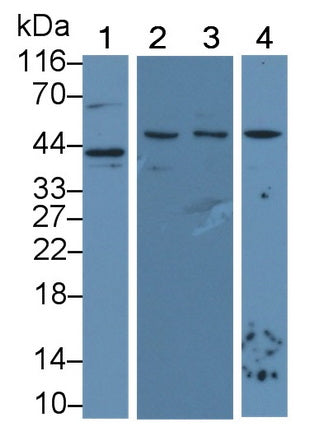 Vascular Endothelial Growth Factor A (VEGFA) Monoclonal Antibody - image 2
