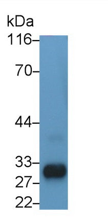 Western Blot; Sample: Lane1: A431 cell lysate; Lane2: MCF7 cell lysate; Primary Ab: 0.2ug/ml Rabbit Anti-Rat KLK11 Antibody; Second Ab: 0.2ug/mL HRP-Linked Caprine Anti-Rabbit IgG Polyclonal Antibody