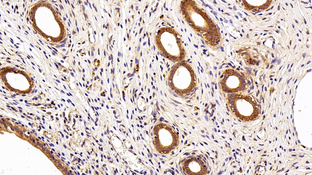 DAB staining on IHC-P; Sample: Rat Kidney Tissue; Primary Ab: 10ug/ml Rabbit Anti-Human MMP7 Antibody; Second Ab: 2ug/mL HRP-Linked Caprine Anti-Rabbit IgG Polyclonal Antibody