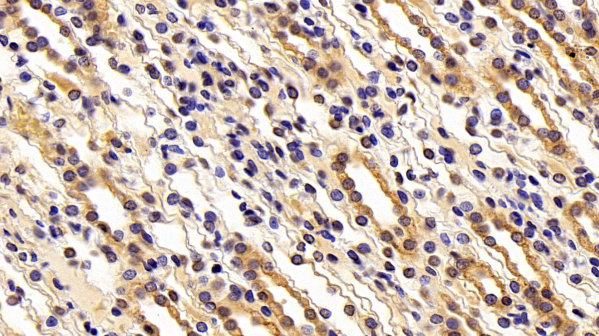 DAB staining on IHC-P; Sample: Rat Stomach Tissue; Primary Ab: 10ug/ml Rabbit Anti-Human MMP7 Antibody; Second Ab: 2ug/mL HRP-Linked Caprine Anti-Rabbit IgG Polyclonal Antibody