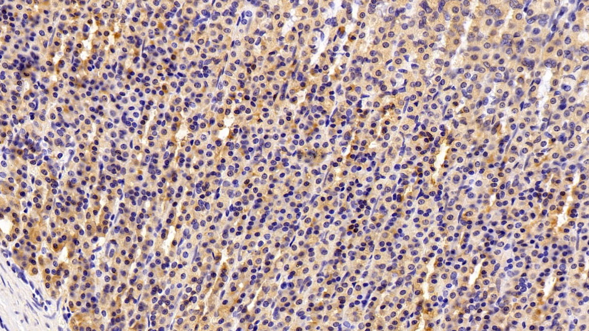 AF488 staining on IF; Sample: A549 cell; Primary Ab: 20ug/ml Rabbit Anti-Human MMP7 Antibody; Second Ab: 2ug/ml AF488-Linked Caprine Anti-Rabbit IgG Polyclonal Antibody