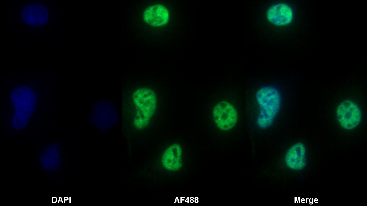 Matrix Metalloproteinase 7 (MMP7) Polyclonal Antibody - image 5