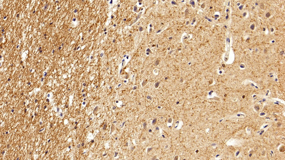 DAB staining on IHC-P; Sample: Porcine Kidney Tissue; Primary Ab: 20ug/ml Rabbit Anti-Porcine HDAC6 Antibody; Second Ab: 2ug/mL HRP-Linked Caprine Anti-Rabbit IgG Polyclonal Antibody