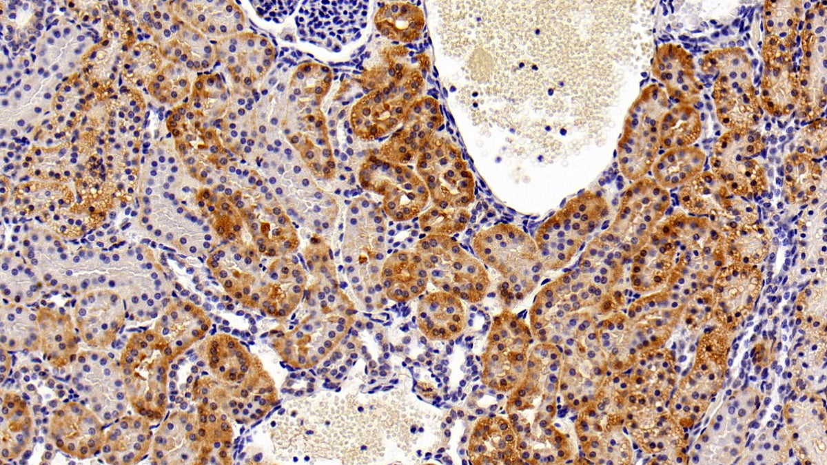 FITC staining on IF; Sample: Human Hela cell; Primary Ab: 20ug/ml Rabbit Anti-Porcine HDAC6 Antibody; Second Ab: 1.5ug/ml FITC-Linked Caprine Anti-Rabbit IgG Polyclonal Antibody