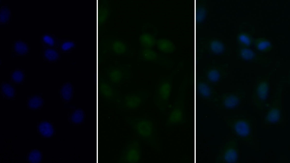 Histone Deacetylase 6 (HDAC6) Polyclonal Antibody - image 4