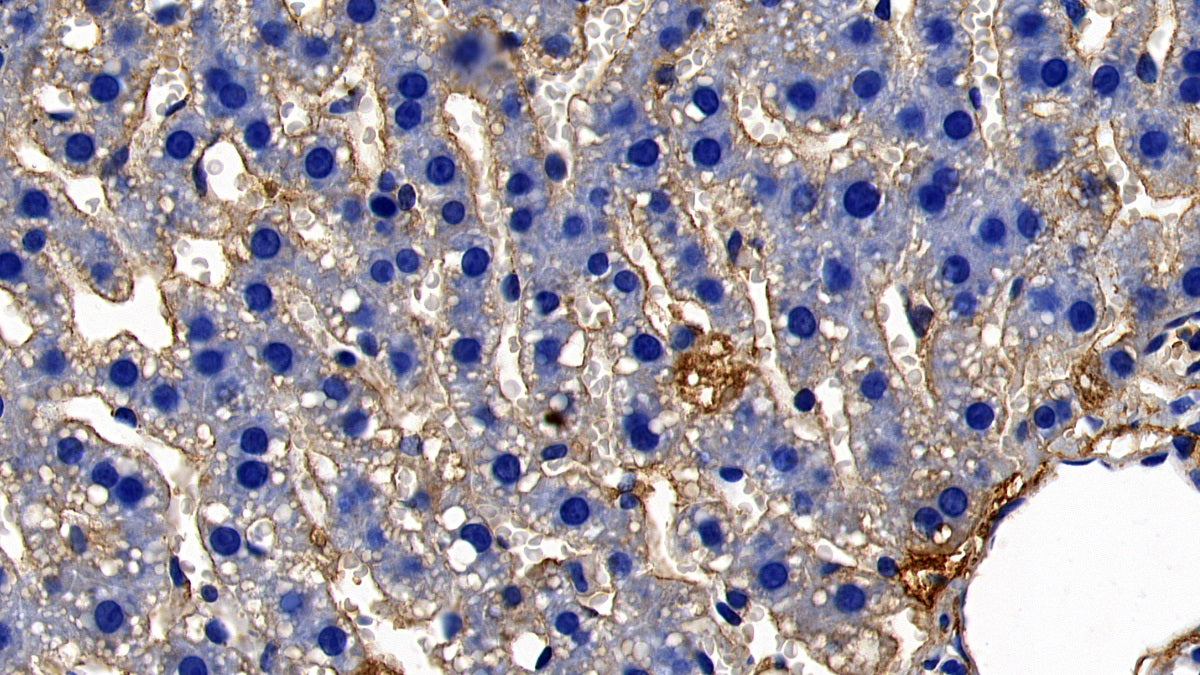 Complement Component 4d (C4d) Polyclonal Antibody - image 2