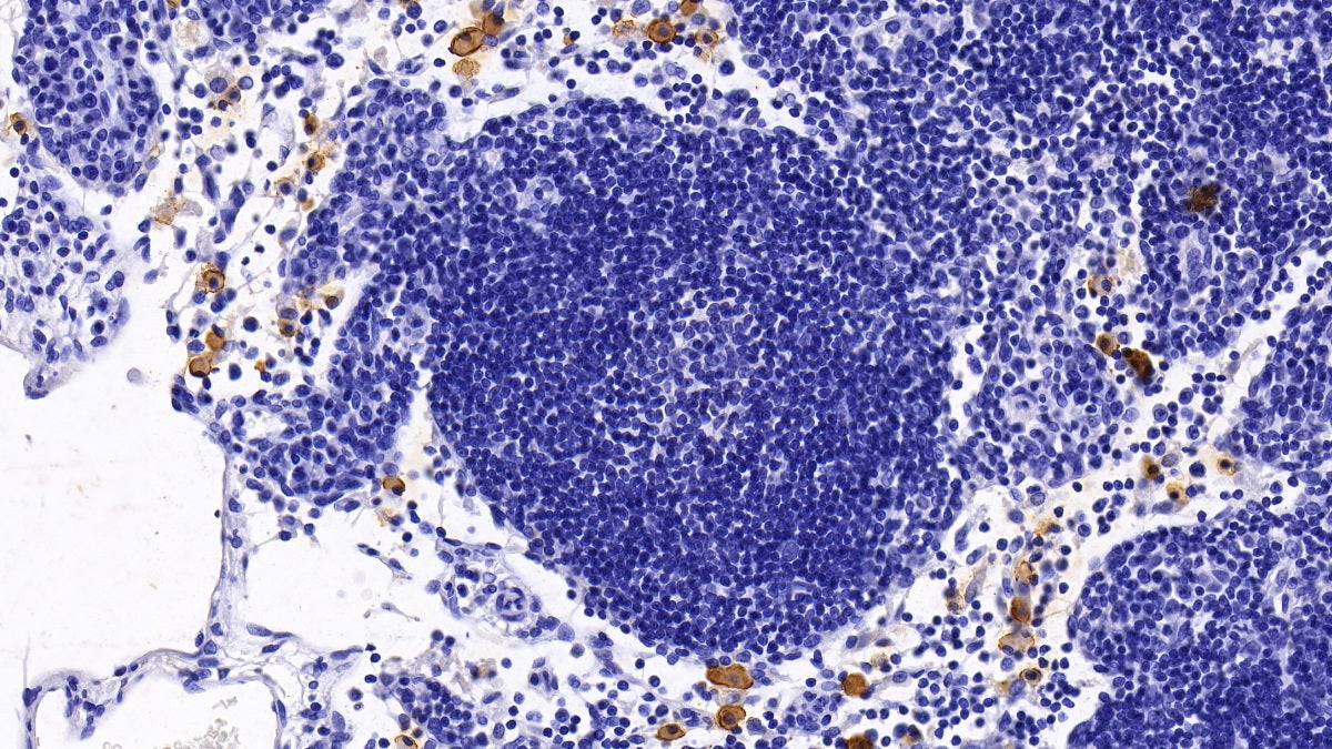 DAB staining on IHC-P; Sample: Rat Lung Tissue; Primary Ab: 30ug/ml Mouse Anti-Human BST1 Antibody; Second Ab: 2ug/mL HRP-Linked Caprine Anti-Mouse IgG Polyclonal Antibody