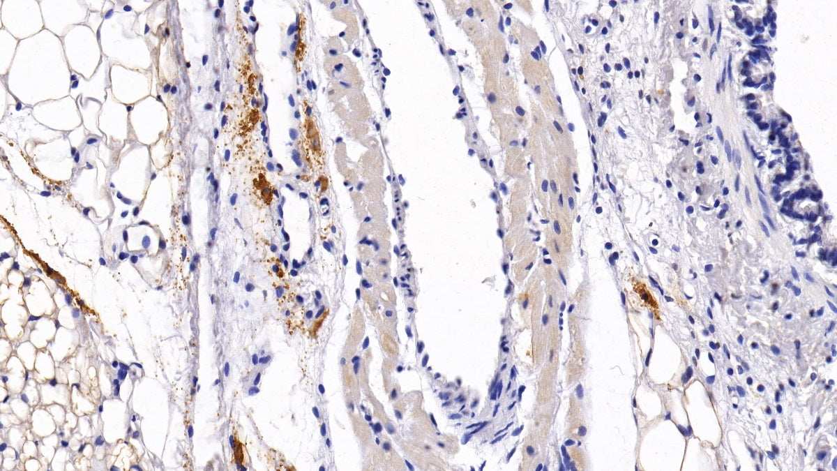 DAB staining on IHC-P; Sample: Rat Thymus Tissue; Primary Ab: 30ug/ml Mouse Anti-Human BST1 Antibody; Second Ab: 2ug/mL HRP-Linked Caprine Anti-Mouse IgG Polyclonal Antibody