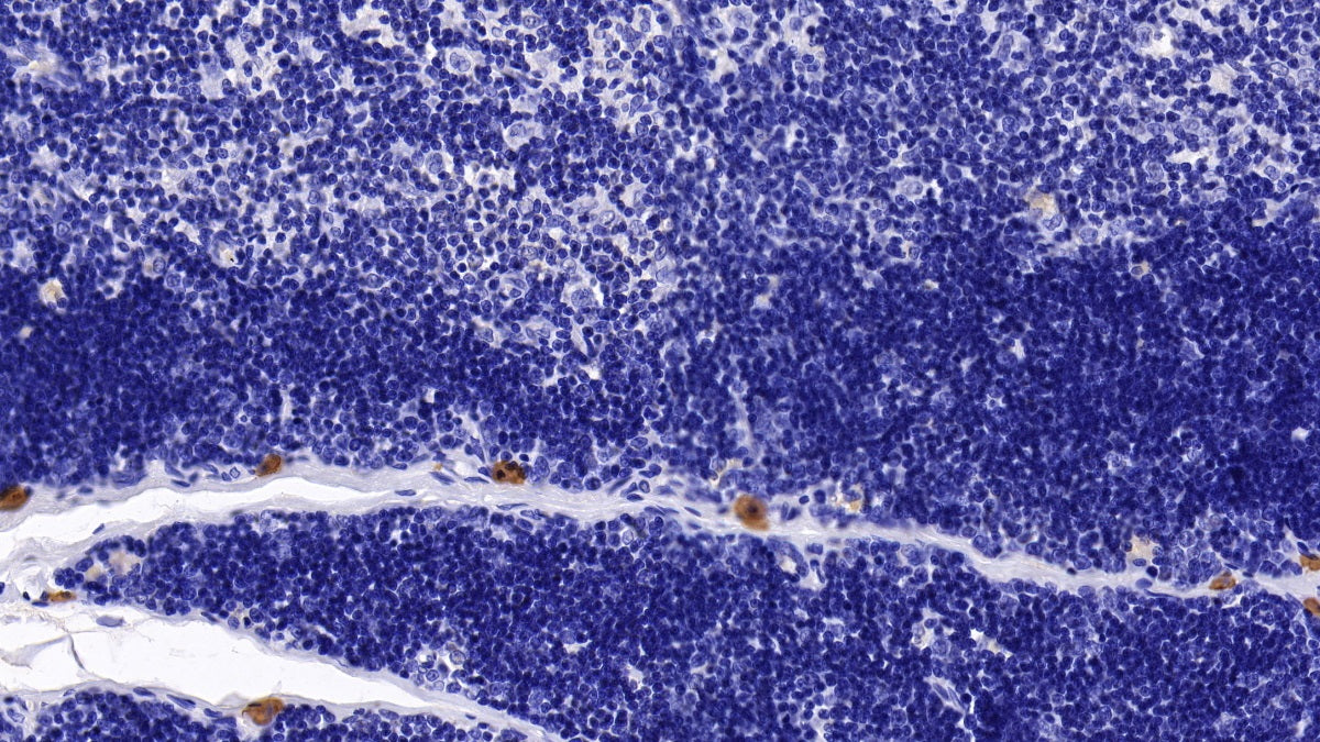 Bone Marrow Stromal Cell Antigen 1 (BST1) Monoclonal Antibody - image 4