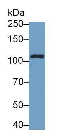 Probable ATP-dependent RNA Helicase DDX58 (DDX58) Monoclonal Antibody - image 2