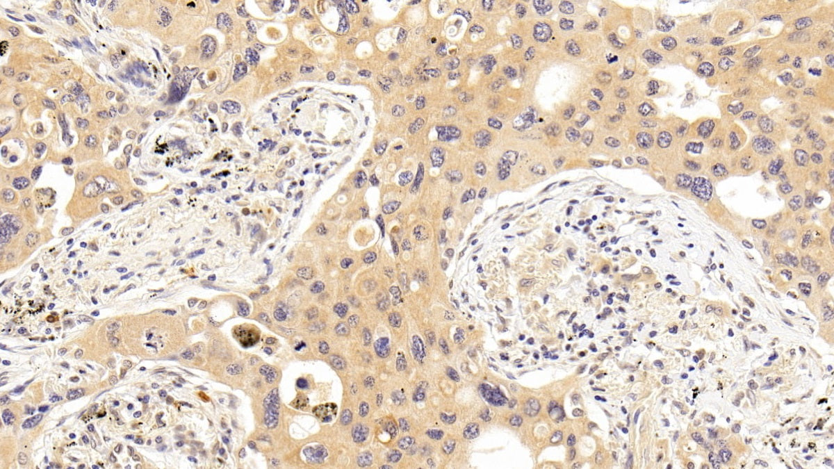 DAB staining on IHC-P; Sample: Human Kidney Tissue; Primary Ab: 20ug/ml Mouse Anti-Human MAPT Antibody; Second Ab: 2ug/mL HRP-Linked Caprine Anti-Mouse IgG Polyclonal Antibody