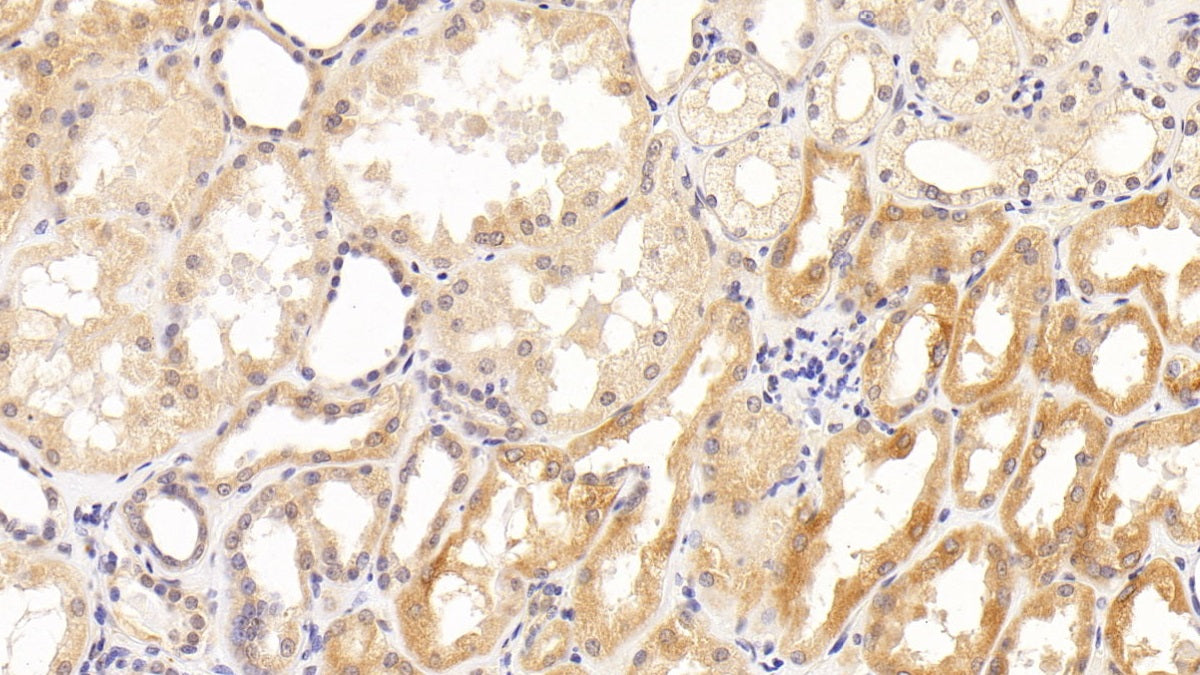 Tau Protein (MAPT) Monoclonal Antibody - image 3