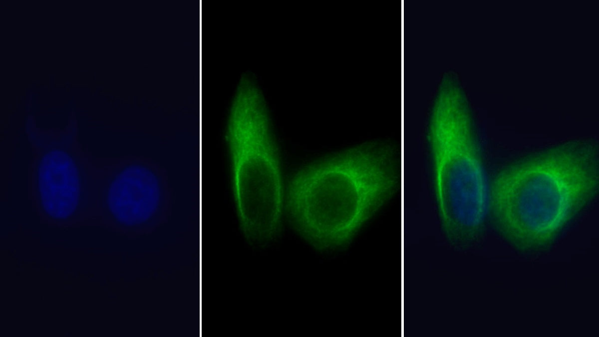 Heat Shock 70kDa Protein 5 (HSPA5) Monoclonal Antibody - image 3