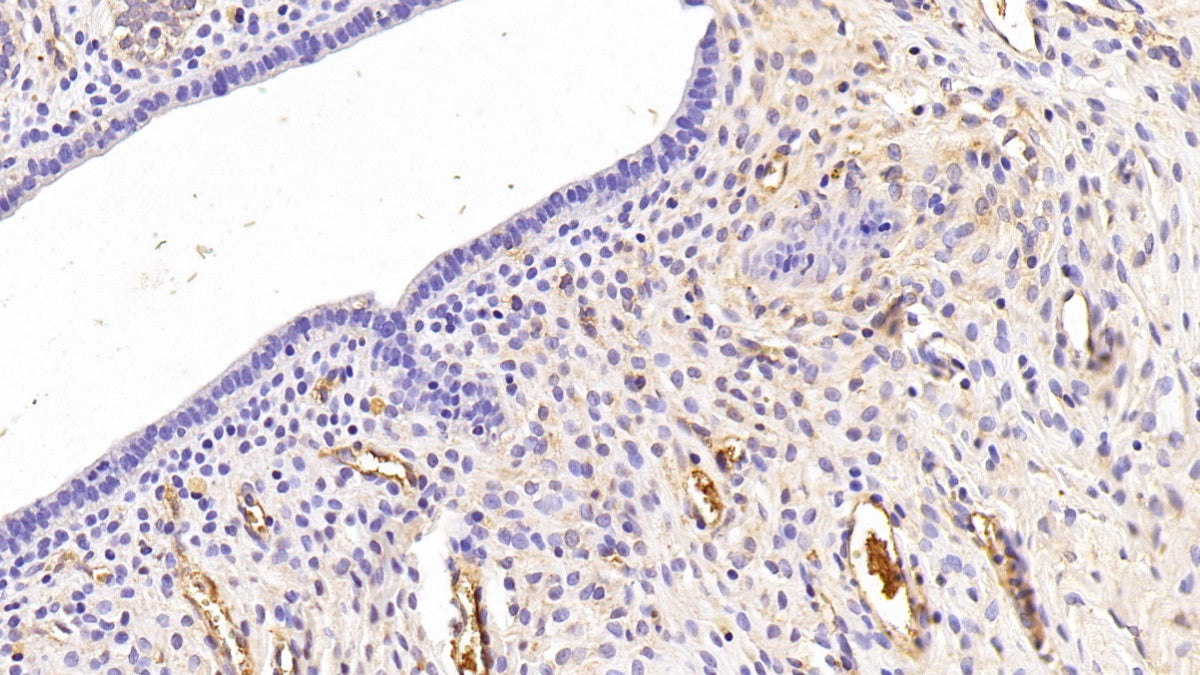 Apolipoprotein A1 (APOA1) Monoclonal Antibody - image 2