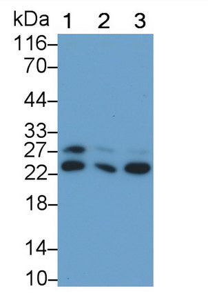 Glutathione S Transferase Pi (GSTp) Monoclonal Antibody - image 5