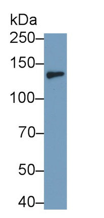 Colony Stimulating Factor 2 Receptor Beta (CSF2Rb) Monoclonal Antibody - image 2