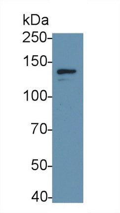 Colony Stimulating Factor 2 Receptor Beta (CSF2Rb) Monoclonal Antibody - image 2