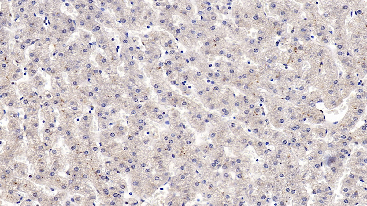 Insulin Like Growth Factor Binding Protein 4 (IGFBP4) Monoclonal Antibody - image 3