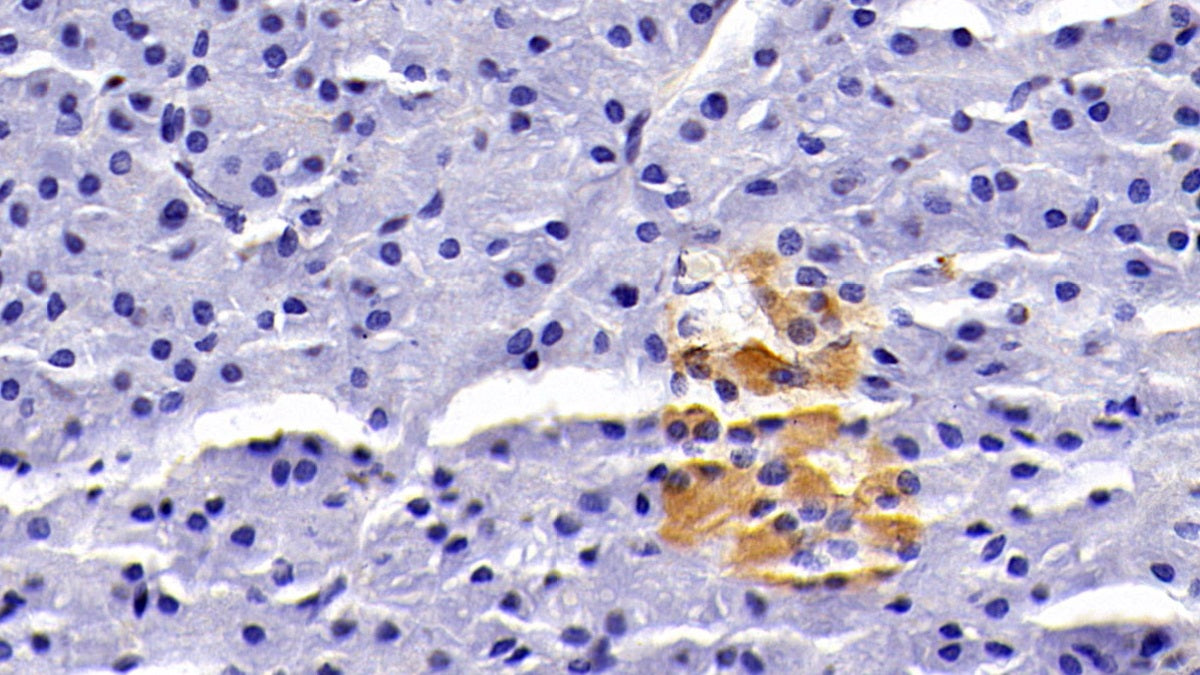 Clusterin (CLU) Monoclonal Antibody - image 3