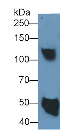 Ceruloplasmin (CP) Monoclonal Antibody - image 2