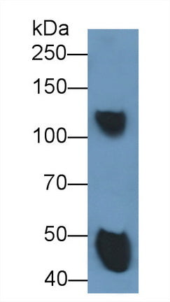 Ceruloplasmin (CP) Monoclonal Antibody - image 2
